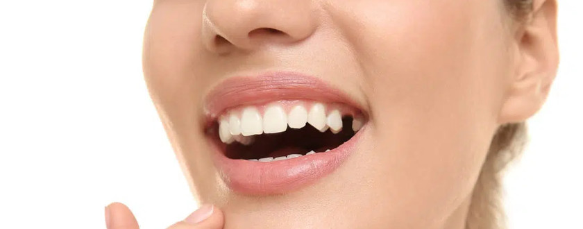 Diento Oral Health Care