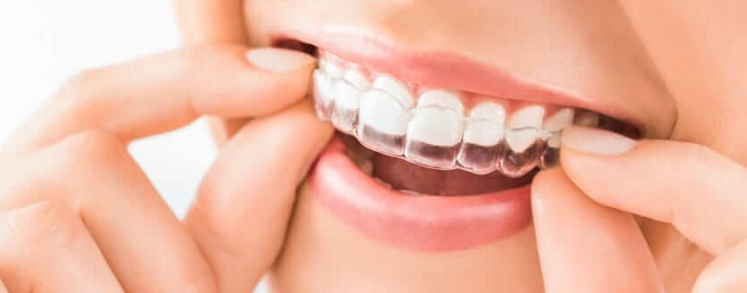 Diento Oral Health Care